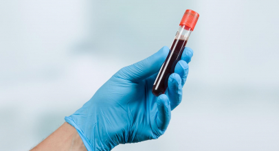 Do czego śni się cudza krew